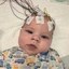 Brain Surgery Fund Icon